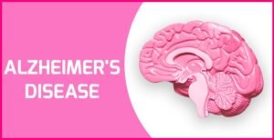 alzheimer’s disease